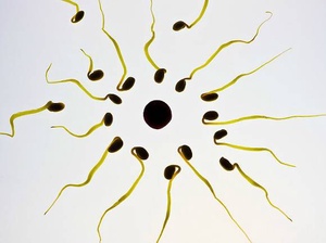 СС0 Public Domain / Количество и качество сперматозоидов у мужчин по всему миру снижается, доказали ученые