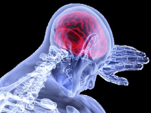 CC0 Public Domain / Лонг-ковид и синдром хронической усталости вызывают схожие изменения в мозге