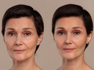 Фото с сайта <a href="https://www.freepik.com/free-photo/antiaging-beauty-treatment_18992360.htm">Freepik</a> / Ученые выяснили, в каком возрасте женщины стареют быстрее всего