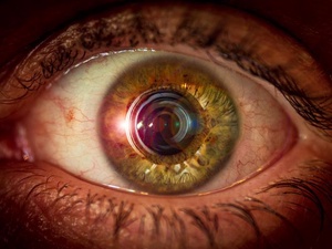 Фото с сайта <a href="https://www.freepik.com/free-photo/eye-with-camera-lens-lens-flare-pupil_24910373.htm">Freepik</a>, image by wirestock / Сканирование глаз позволяет выявить болезнь Паркинсона за много лет до появления симптомов