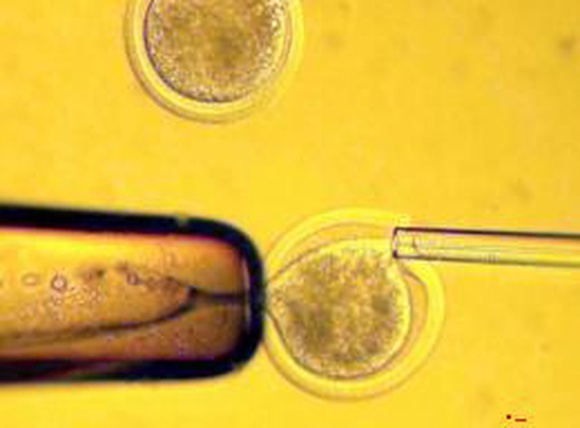 Ученые определили оптимальное количество эмбрионов для успеха ЭКО